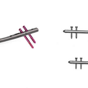 Femoral Interlocking Nail (Ø 11 mm)