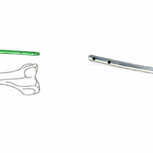 Femoral Interlocking Nail (Ø 12 mm)